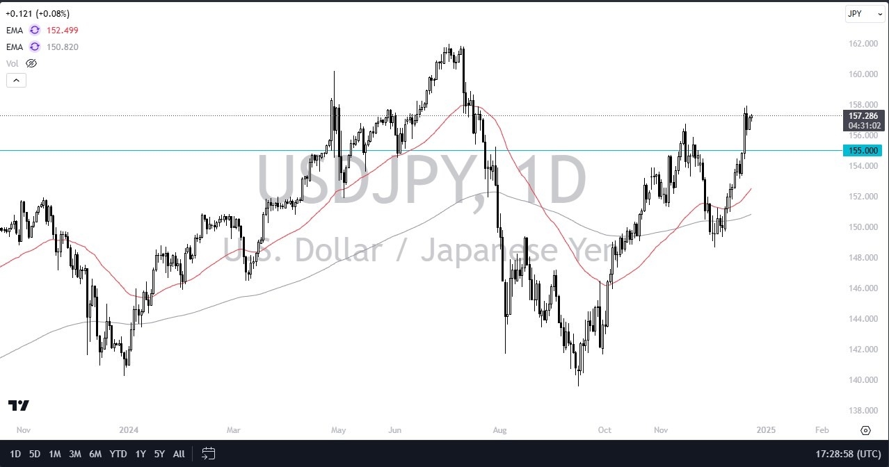 【XM Market Analysis】--USD/JPY Forecast: Dollar Continues to Shine(图1)