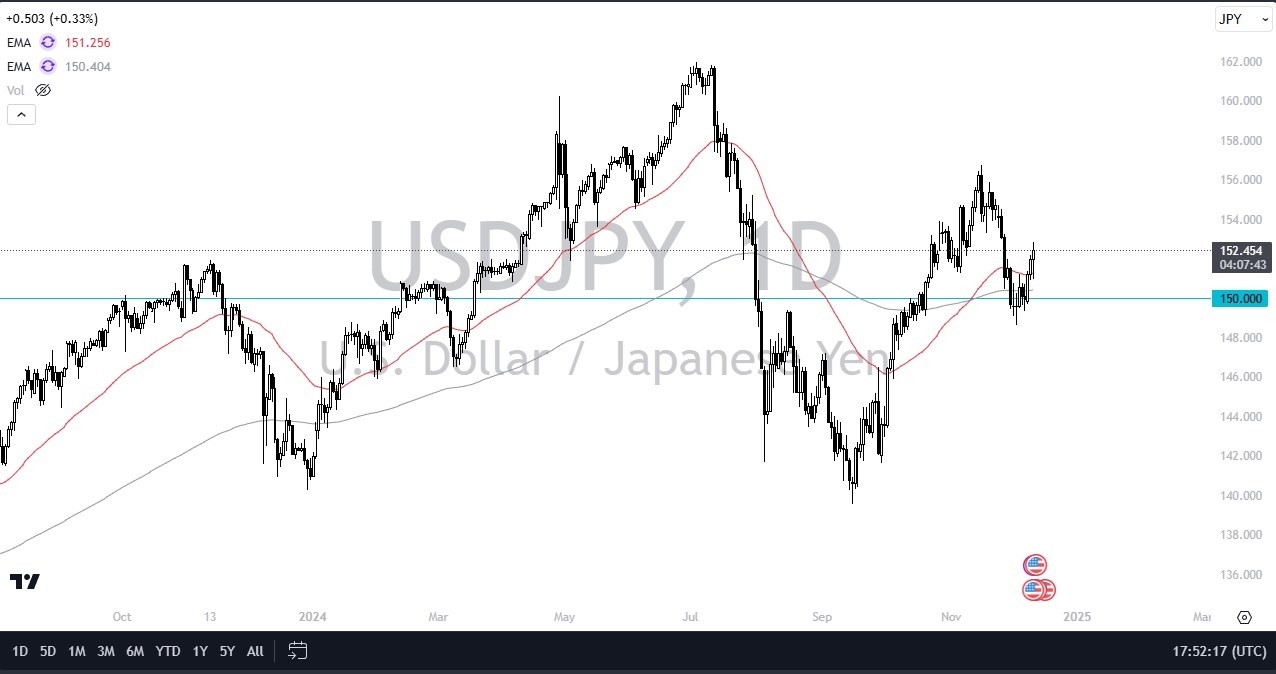 【XM Market Analysis】--USD/JPY Forecast: Rises Amid Interest Rate Divergence(图1)