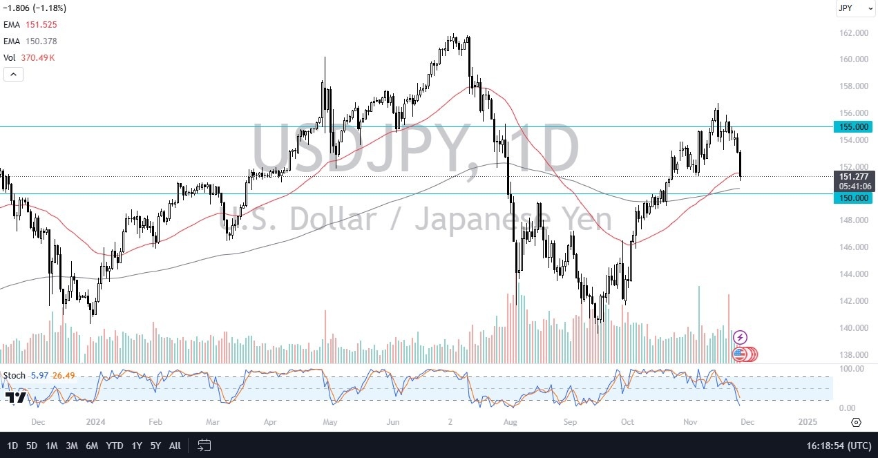 【XM Decision Analysis】--USD/JPY Forecast: Near Key Support at 150(图1)