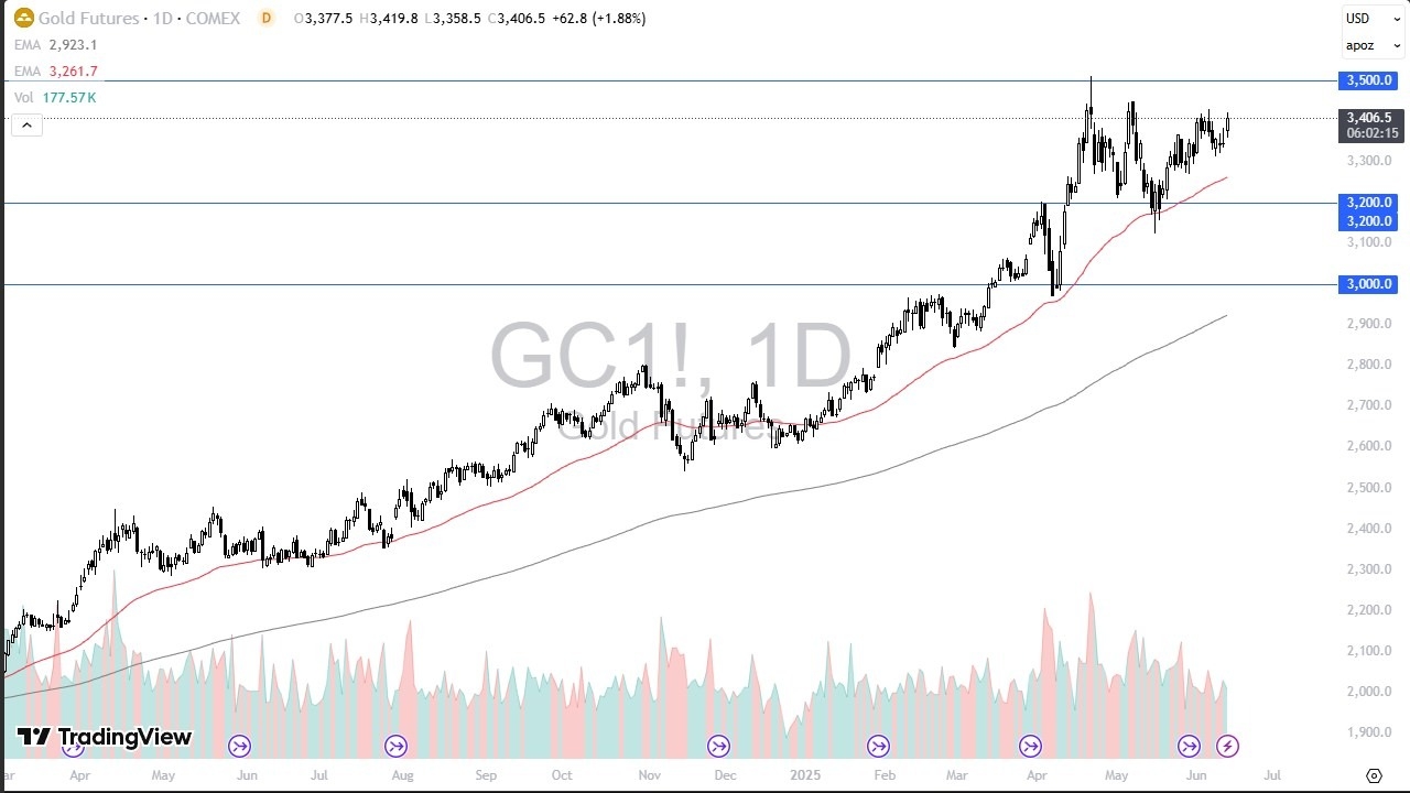 【XM Market Analysis】--Gold Forecast: Pressure to the Upside(图1)