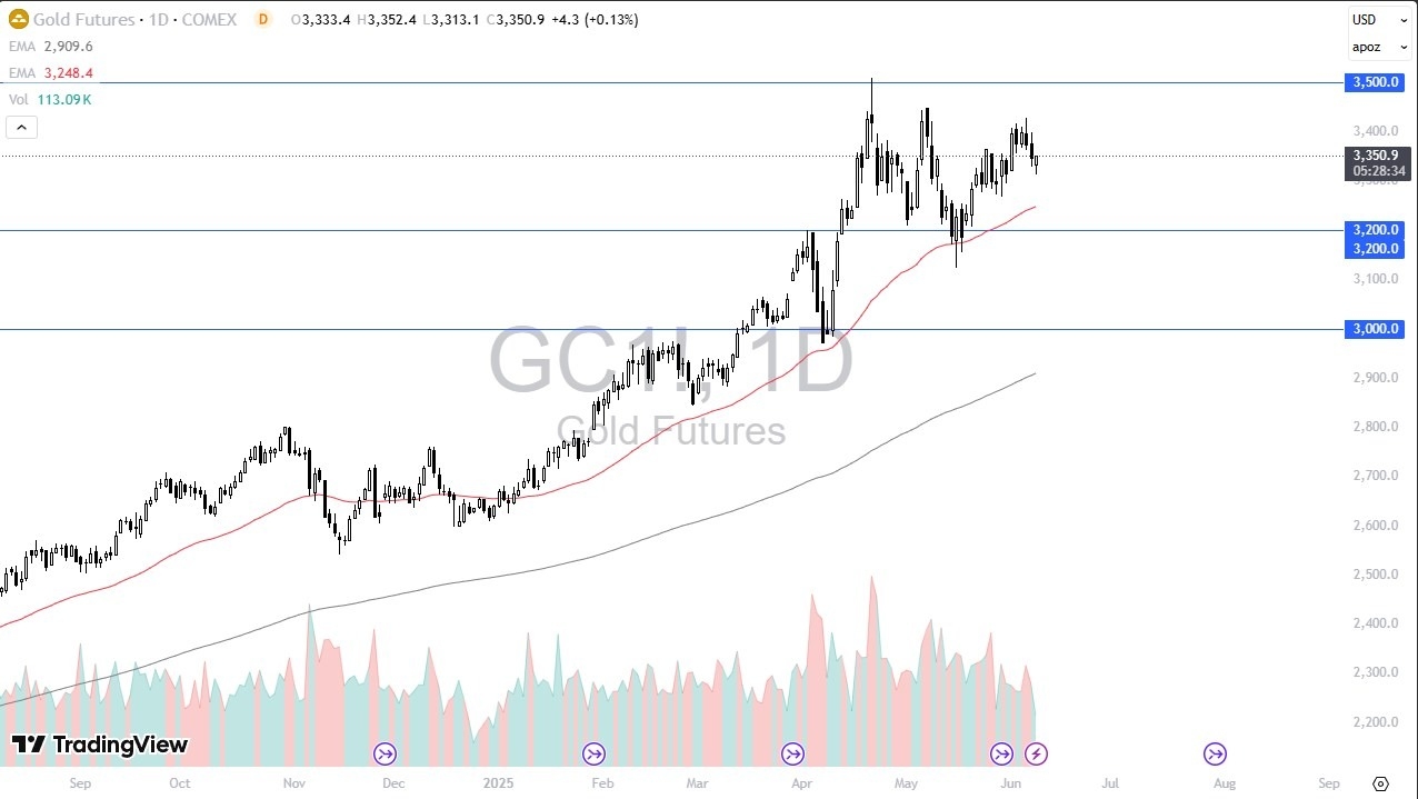 【XM Market Review】--Gold Forecast: Finding Buyers on Dips(图1)