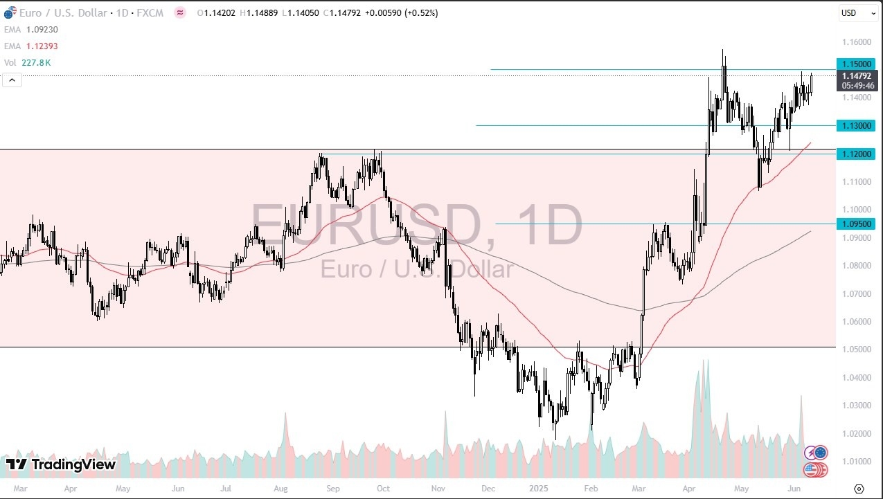 【XM Market Review】--EUR/USD Forecast: Pressuring the US Dollar(图1)